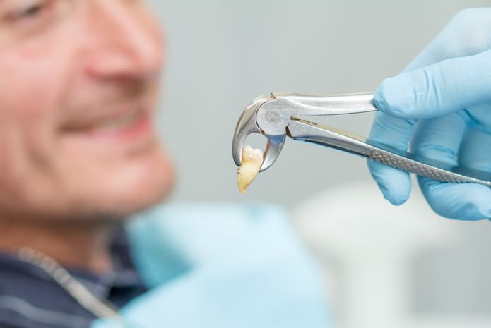 Extracción Dental: qué es, características, beneficios y recomendaciones