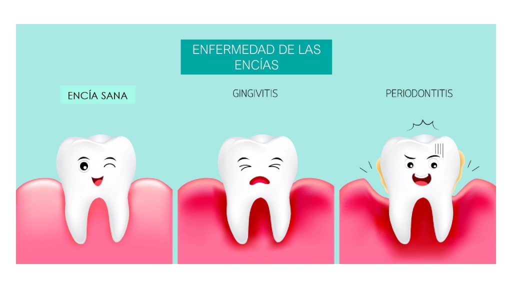 Hablemos de las encías: cómo cuidarlas en 8 pasos