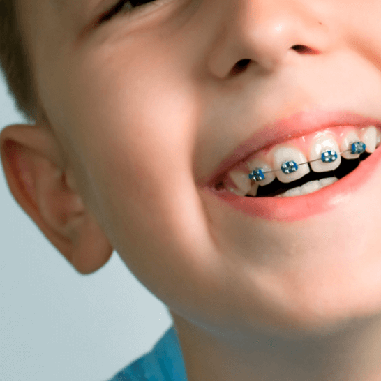 ¿Por qué hacer una ortodoncia a los menores de edad?